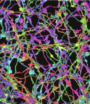 neural network